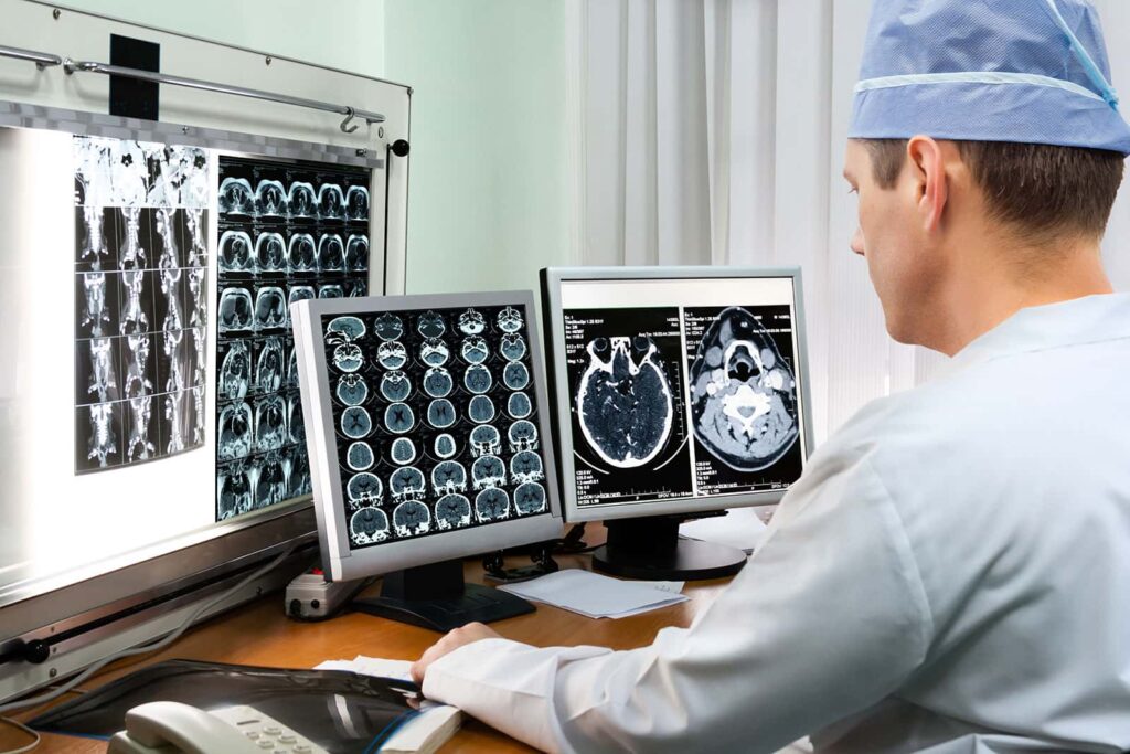 A doctor examining MRI scans on a screen in a medical setting.